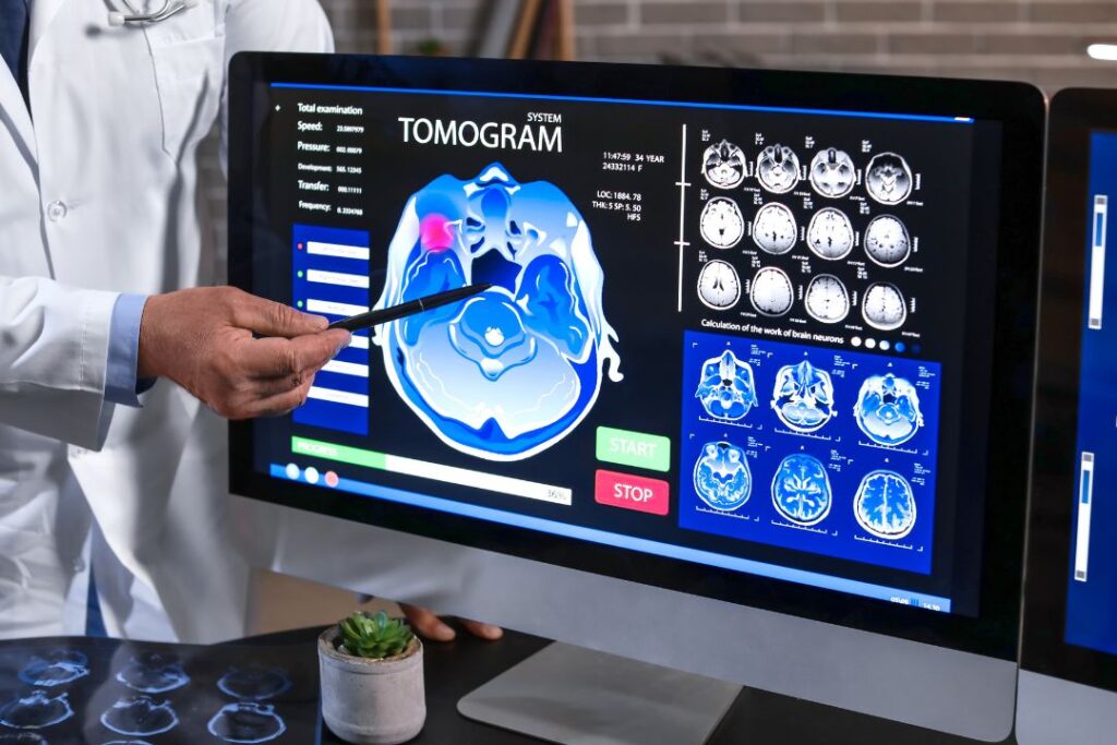 Department of Neurology